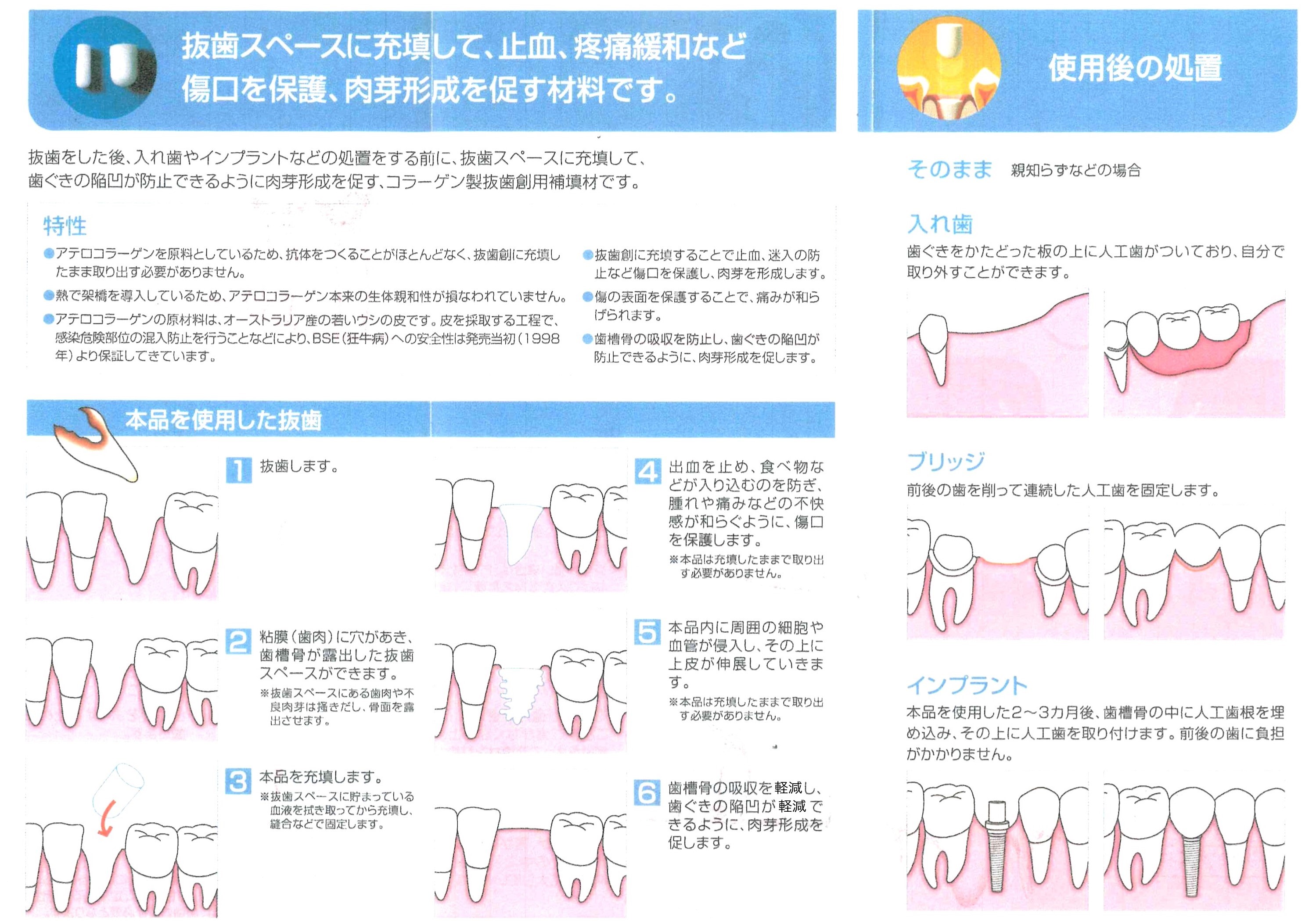テルプラグパンフレット